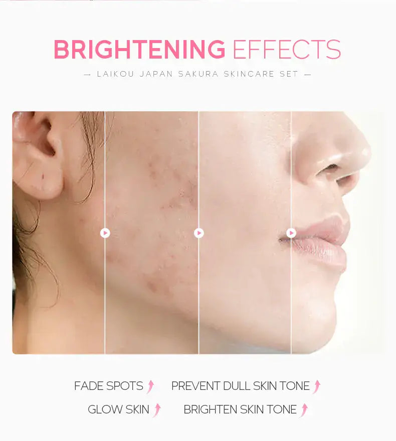 Hydrating Face Cream 5-Piece Skincare Set showing before and after brightening effects on skin.