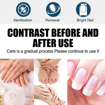 South Moon Nail Care Repair Liquid for Healthy Nails