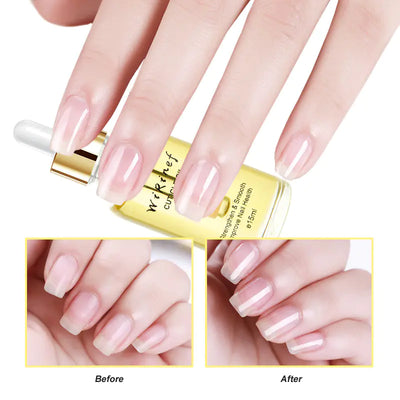 Nail Care Oil with Plant Extracts for Manicure