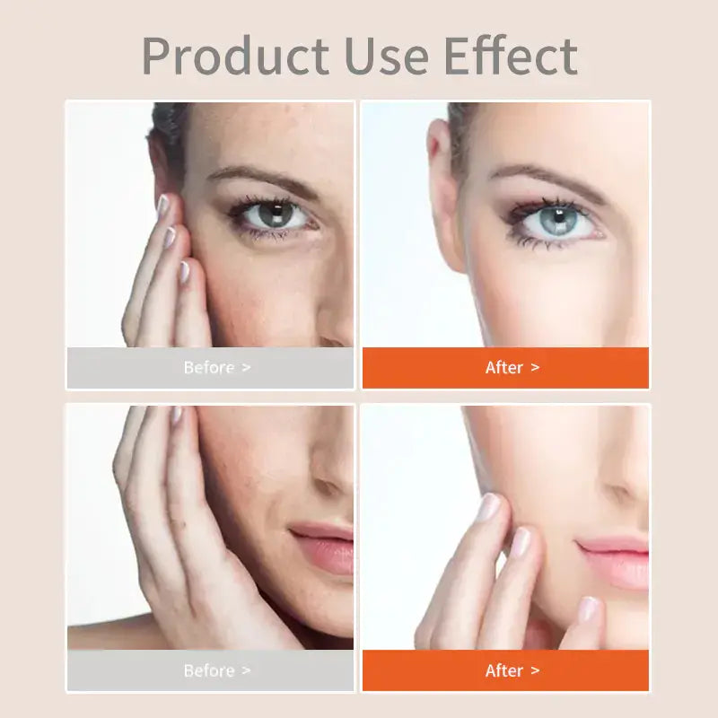 Product Use Effect: Before and after results showcasing the transformation from the Turmeric Skincare Set | Natural Glow for Radiant Skin.