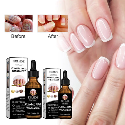 EELHOE Nail Repair Solution, Thickening And Brightening Nails