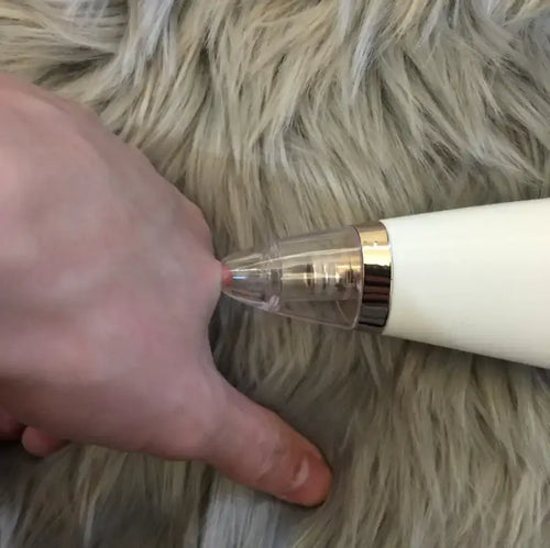 Blackhead Removal Device for Pore Cleansing and Skincare shown in action on hand to demonstrate suction technology.