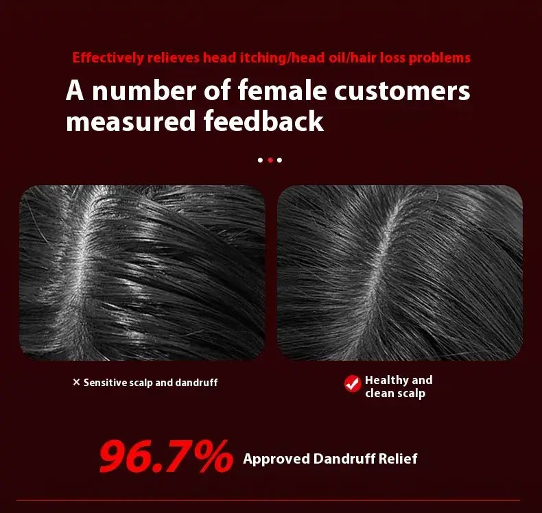 Electric Scalp Massage Comb comparison showing sensitive scalp with dandruff versus healthy, clean scalp